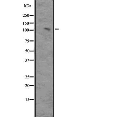 MAP3K14 Antibody