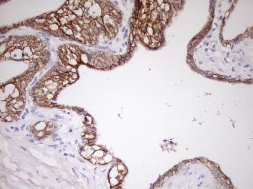CDH1 / E Cadherin Antibody (clone UMAB184)