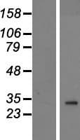 PANK2 Protein (Over-Expression Lysate Myc-DDK (Flag))