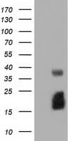 EFNA2 / Ephrin A2 Antibody (clone OTI2E6)