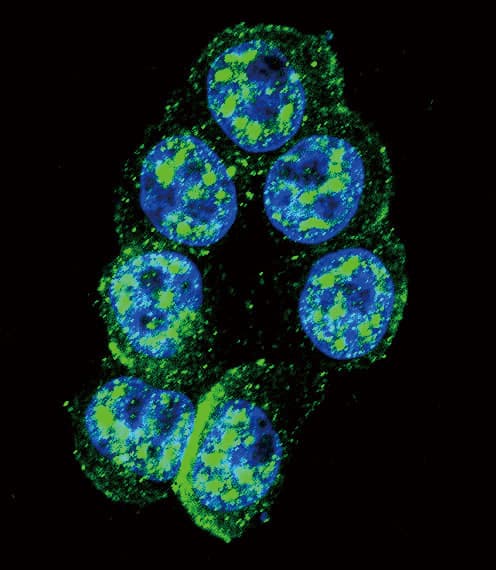 PAK1 Antibody (phospho-Thr423)