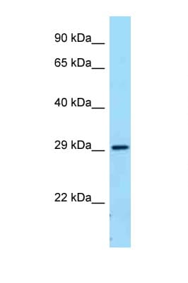 Polyclonal Rabbit anti-Human CD32B Antibody (C-Terminus, WB)