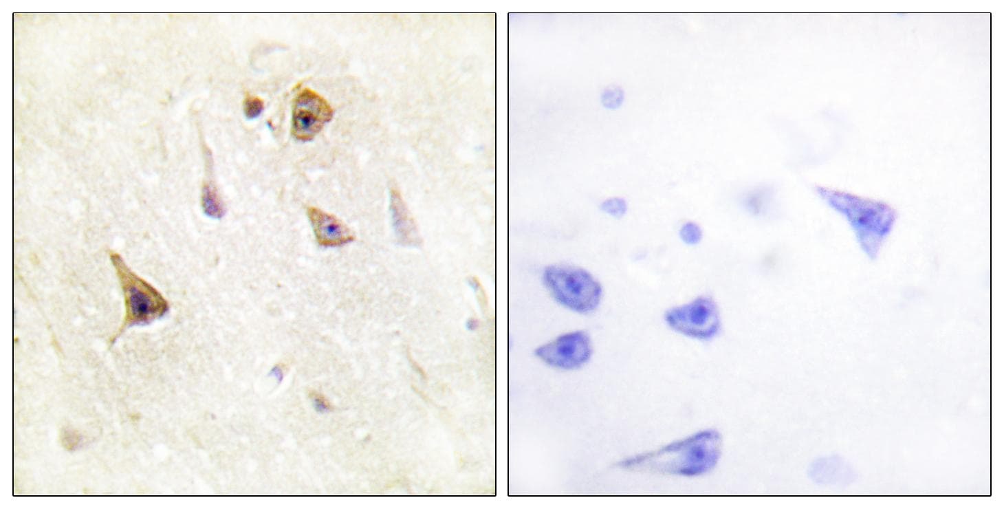 Polyclonal Rabbit anti-Human WASF1 / WAVE Antibody (p125, IHC, IF, WB)