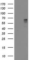 ALDH3A2 Antibody (clone OTI1D1)