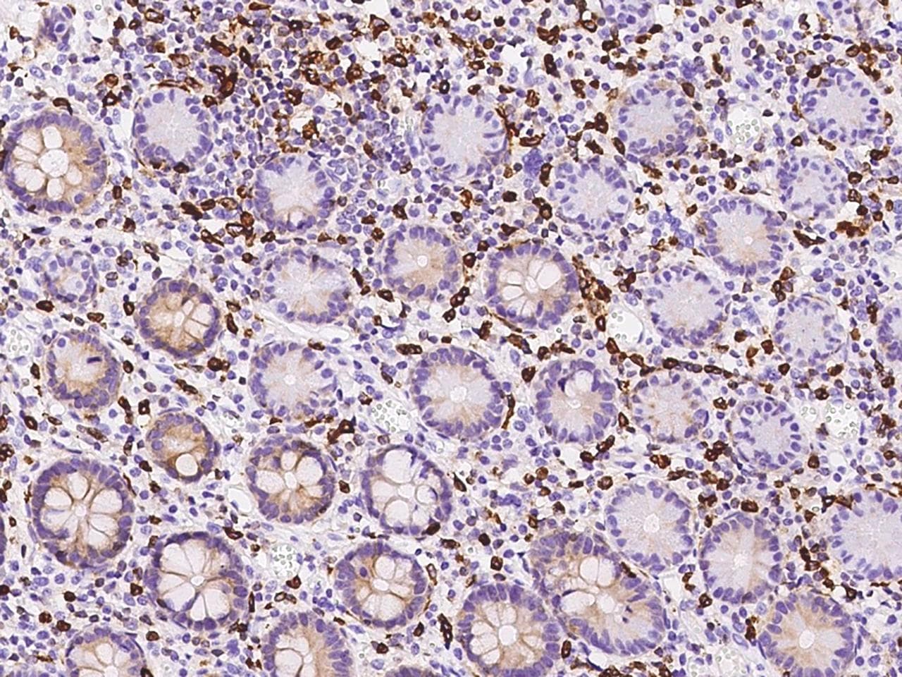 Polyclonal Rabbit anti-Human APOBR / APOB48R Antibody (IHC)