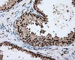 ERCC1 Antibody (clone OTI2H5)