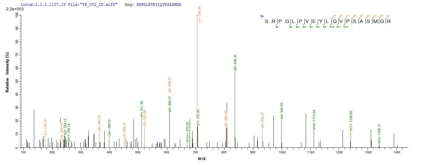 Mycobacterium tuberculosis fbpC Protein (Recombinant 6His, N-terminus)