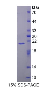 Mouse CAPN1 / Calpain 1 Protein (Recombinant His)