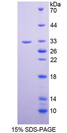 Human NID1 / Entactin / Nidogen-1 Protein (Recombinant His-T7)