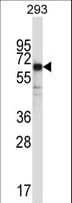 Polyclonal Rabbit anti-Human SYT6 / Synaptotagmin 6 Antibody (aa483-510, IHC, WB)