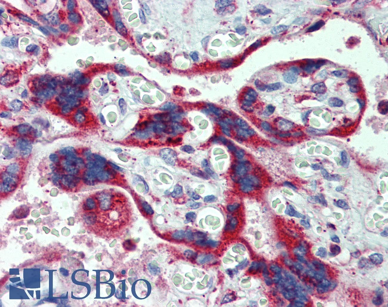 Polyclonal Rabbit anti-Human P450SCC / CYP11A1 Antibody (aa288-337, IHC, WB)