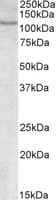 IHC-plus™ NFAT1 / NFATC2 Antibody (aa729-743)
