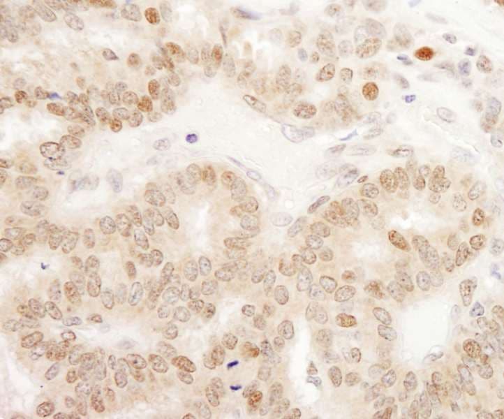 IHC-plus™ Polyclonal Rabbit anti-Human CRTC1 / MECT1 / TORC1 Antibody (aa600-C-term, IHC, WB)