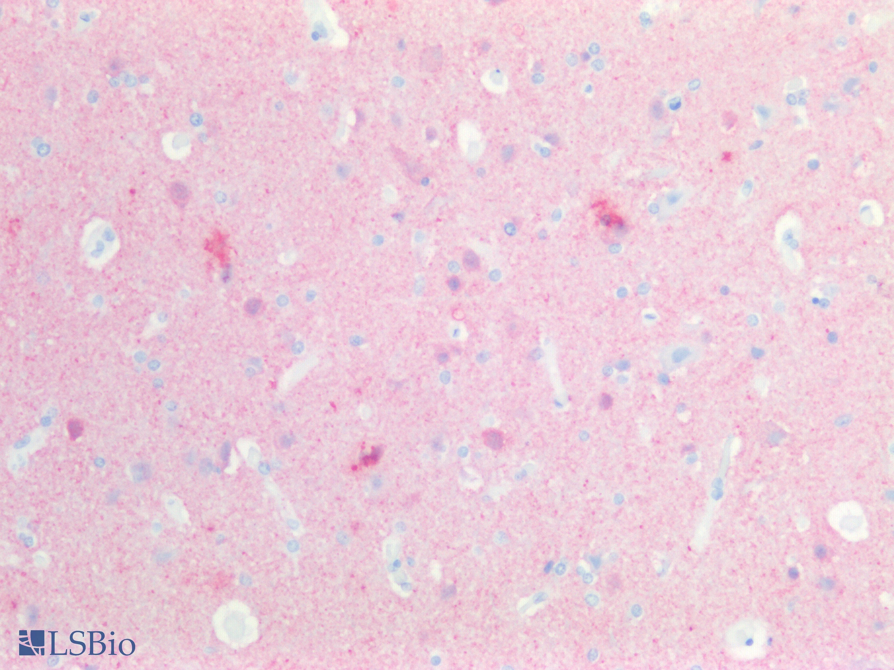 PathPlus™ UCHL1 / PGP9.5 Antibody (aa150-C-term)