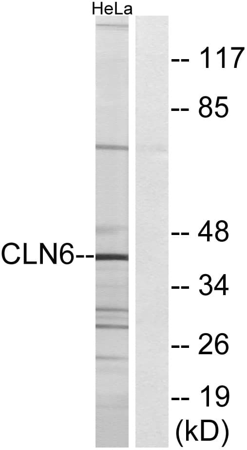 CLN6 Antibody (aa221-270)