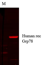 HSPA5 / GRP78 / BiP Antibody (clone 1H11-1H7)