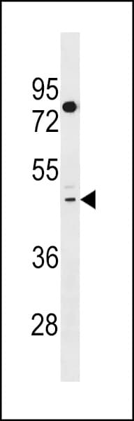 T2R41 / TAS2R41 Antibody (aa14-40)