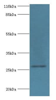 HSD17B14 Antibody (aa1-270)