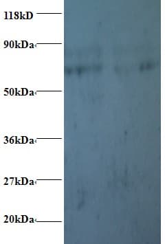 IHC-plus™ PFDN5 / MM1 Antibody
