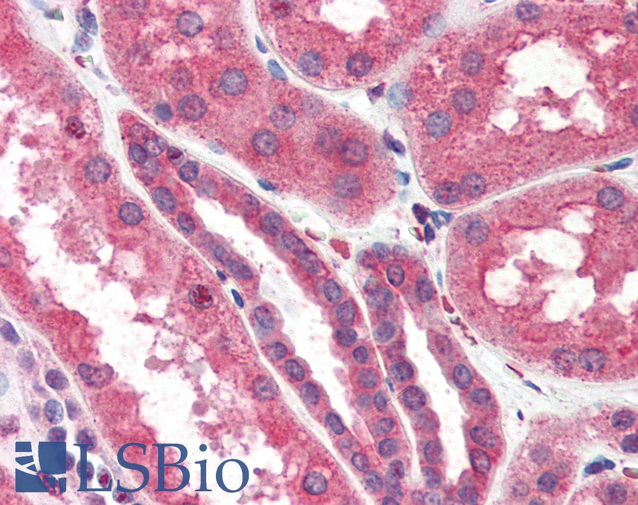 IHC-plus™ ITPR2 / IP3 Receptor Type 2 Antibody (aa1152-1164)