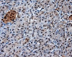GBE1 Antibody (clone OTI3B4)