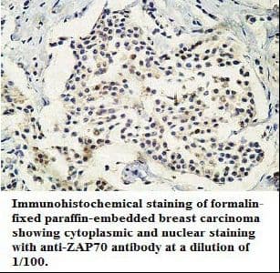 ZAP70 Antibody (aa71-303)