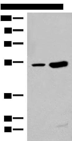 ZBTB43 Antibody