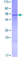Human RDH8 Protein (Recombinant GST)