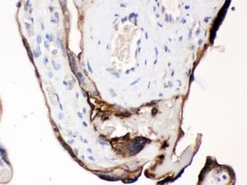 Polyclonal Rabbit anti-Human CDCP1 Antibody (IHC, WB)