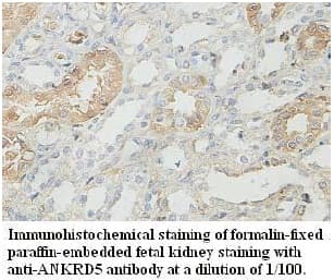 ANKEF1 / ANKRD5 Antibody (aa91-305)