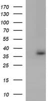 TOLLIP Antibody (clone OTI2E6)