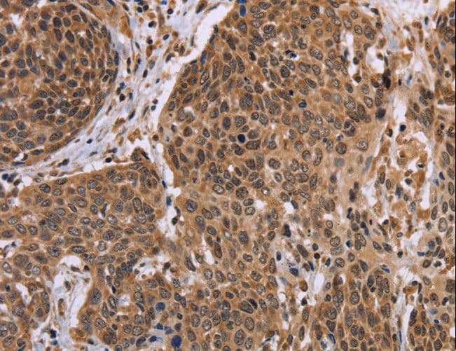 EDN2 / Endothelin 2 Antibody