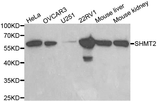 IHC-plus™ SHMT / SHMT2 Antibody