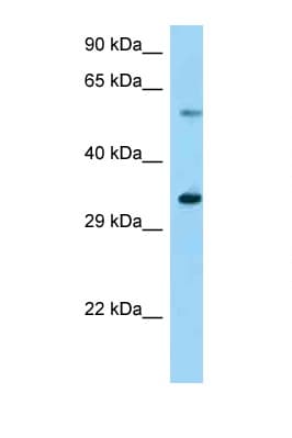 USP27X Antibody (aa91-140)