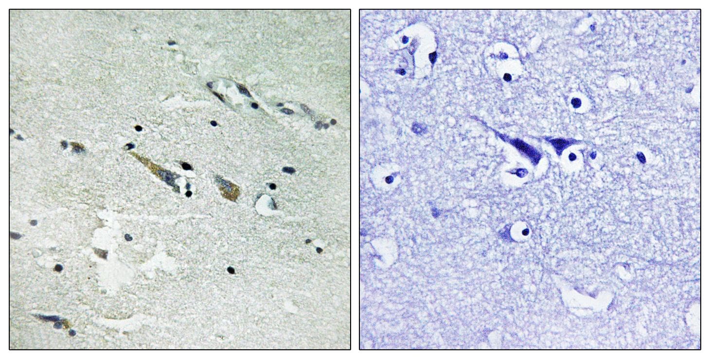 RAF1 / RAF Antibody (p289)