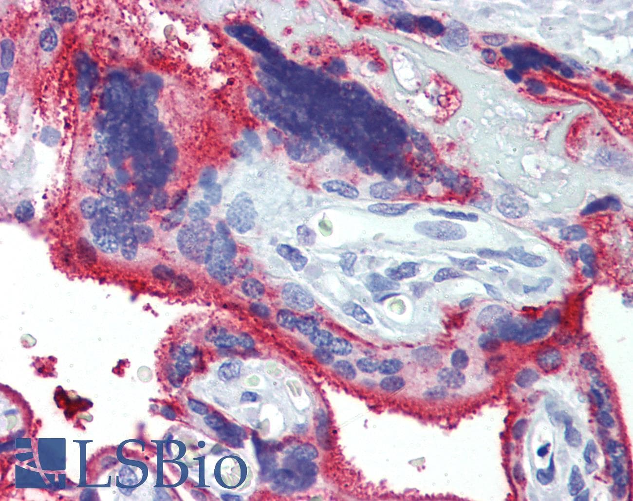 IHC-plus™ NT5E / eNT / CD73 Antibody (clone 1D7)