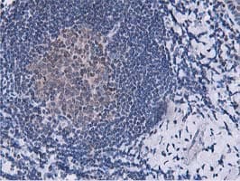 Dipeptidyl Peptidase 3 / DPP3 Antibody (clone OTI2D9)