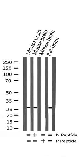 CDKN1B / p27 Kip1 Antibody (phospho-Thr187)