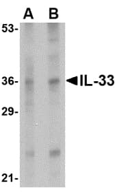 IHC-plus™ Polyclonal Rabbit anti-Human IL-33 Antibody (IHC, IF, WB)