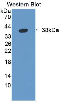 GBP4 / Mpa2 Antibody (aa1-304, Cy3)