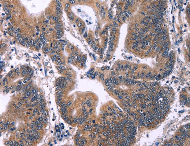 Polyclonal Rabbit anti-Human ING2 Antibody (IHC)