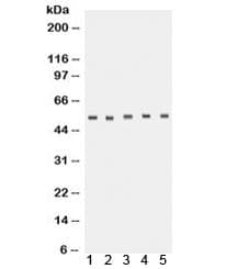 TACR1 / NK1R Antibody