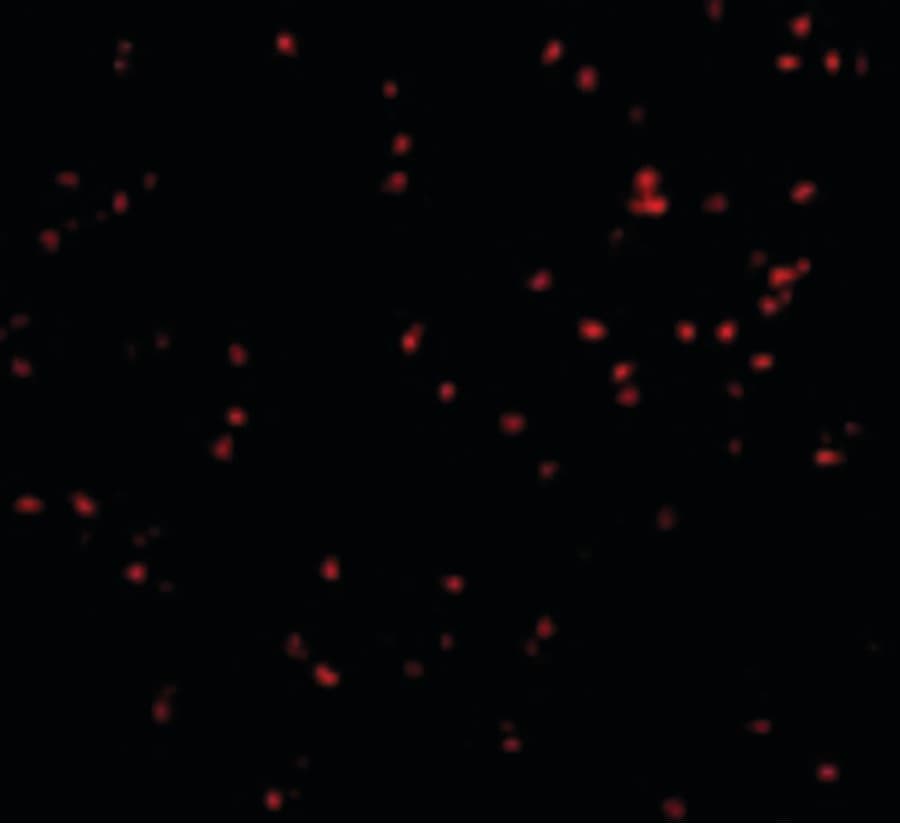 ERN1 / IRE1 Antibody