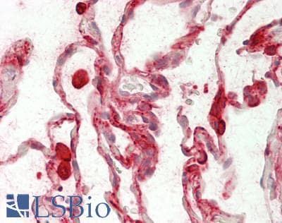 IHC-plus™ Carboxylesterase 1 / CES1 Antibody
