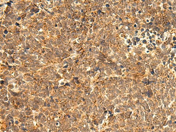 Polyclonal Rabbit anti-Human ABHD10 Antibody (IHC)