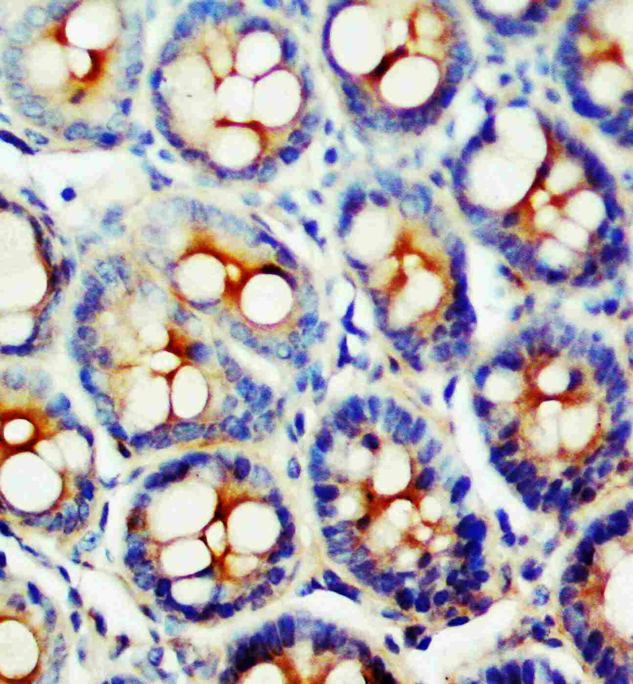 SSTR1 Antibody (aa361-381)