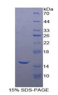 Human CEA / Carcinoembryonic Antigen Protein (Recombinant His)