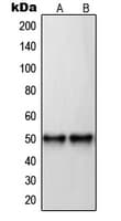 RARB / RAR Beta Antibody (C-Terminus)