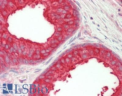 IHC-plus™ Polyclonal Rabbit anti-Human NEDD4L / NEDD4-2 Antibody (aa225-275, IHC, WB)