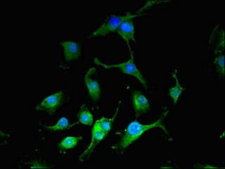 IOP1 / NARFL Antibody